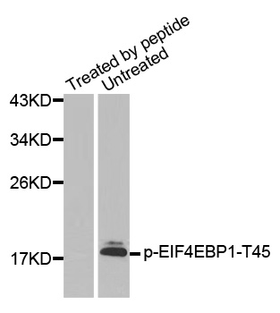 EIF4EBP1 Antibody (Phospho-Thr45) (OAAN02860) in HeLa Cells using Western Blot