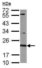 Anti-CD81 antibody