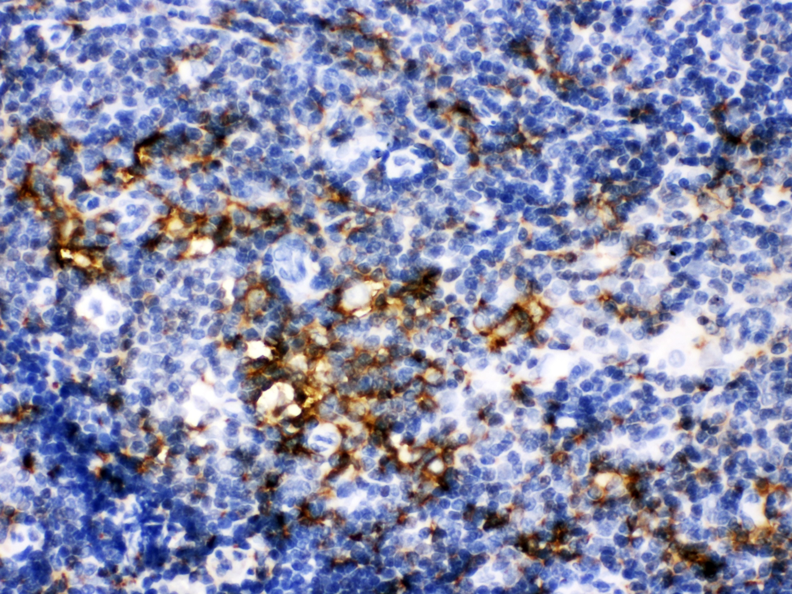IBA1 Antibody - C-terminal region (OABB02125) in Rat Thymus Tissue using Immunohistochemistry