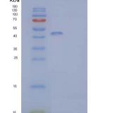 小鼠HLADG/CD74重组蛋白C-mFc-6His