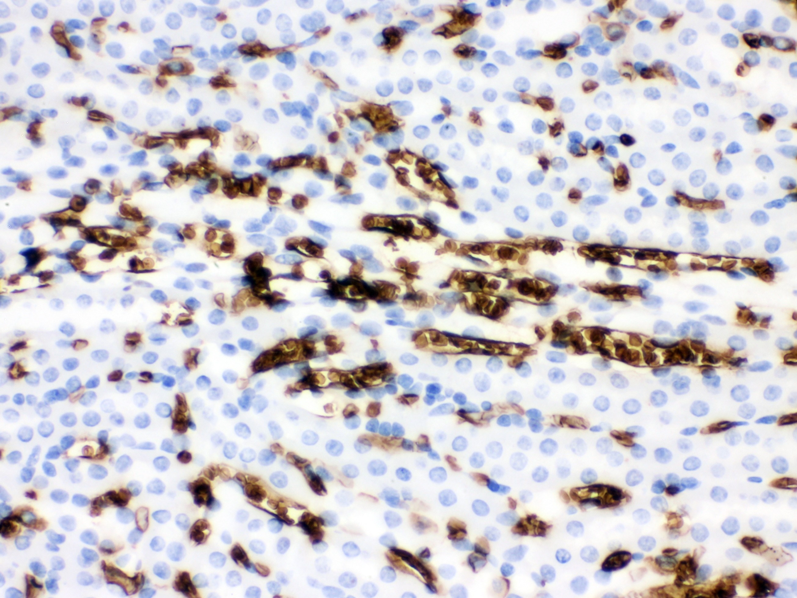BAND 3 Antibody (OABB01920) in Mouse Kidney Tissue using Immunohistochemistry