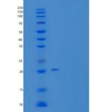 小鼠胶原α-1（XVIII）链/内皮抑制素重组蛋白C-6His