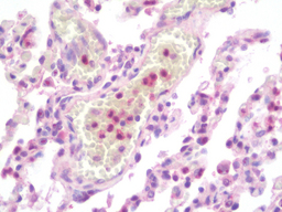 MMP9 Antibody (OALA07723) in Human Lung using ELISA