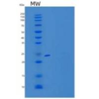 小鼠HLA类组织相容性抗原γ链重组蛋白