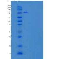 人肝配蛋白A受体8(EPHA8)重组蛋白C-Fc