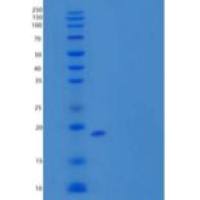小鼠内皮细胞特异性分子1重组蛋白