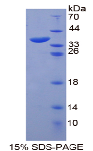 ANK1 Recombinant Protein (OPCD01333) using SDS-PAGE