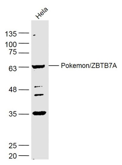 扑克蒙蛋白抗体