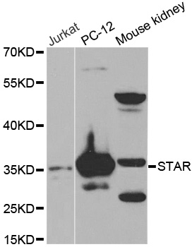 STAR Antibody (OAAN00180) in Multiple Cell Lines using Western Blot