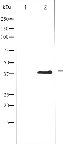 AURKB Antibody (Phospho-Thr232) (OAAJ02762) in COS7 whole cell lysates using Western Blot