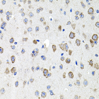 CDH23 Antibody (OAAN00960) in Mouse Brain using Immunohistochemistry
