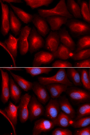 PSMA5 Antibody (OAAN01499) in U20S Cells using Immunofluorescence