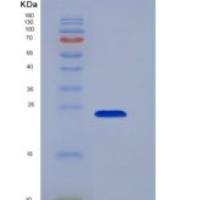 人CD16a / FCGR3A 重组蛋白176 Val, His tag