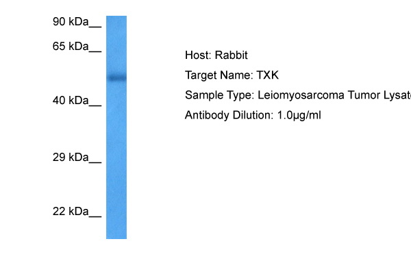 TXK Antibody - N-terminal region (ARP76673_P050) in Human leiomyosarcoma using Western Blot