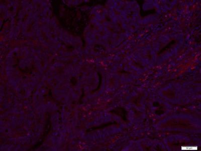 肿瘤转移抑制蛋白BAMBI抗体