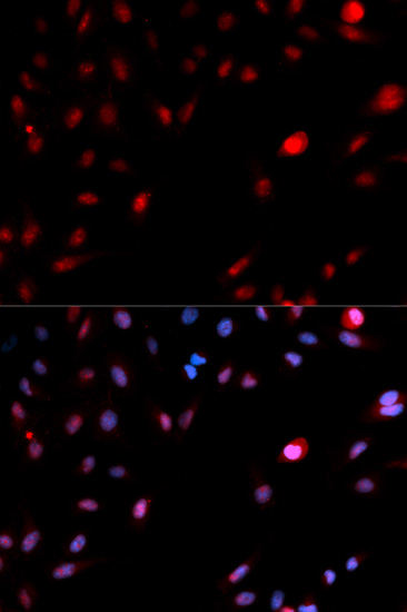 CDK1 Antibody (Phospho-Tyr15) (OAAN02725) in MCF7 Cells using Immunofluorescence