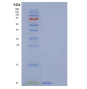 大鼠C-C基序趋化因子5重组蛋白