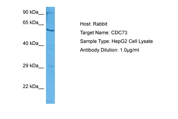 CDC73 Antibody - middle region (ARP80920_P050) in Human HepG2 Whole Cell using Western Blot