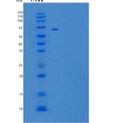 小鼠Nogo-66受体/网状蛋白4受体/NgR/RTN4R重组蛋白C-Fc