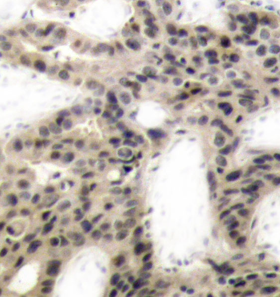 EIF4EBP1 Antibody (Phospho-Thr45) (OAAN02860) in Human Breast using Immunohistochemistry