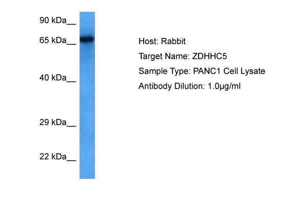 ZDHHC5 Antibody - middle region (ARP78755_P050) in Human PANC1 Whole Cell using Western Blot