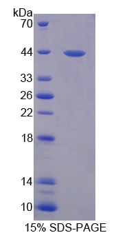 CBL Recombinant Protein (OPCD06728) using SDS-PAGE