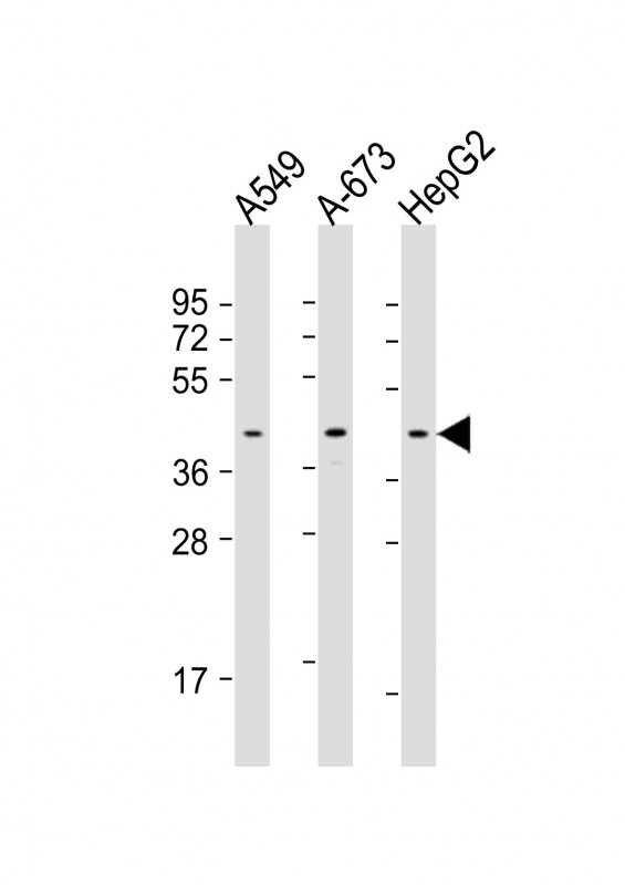 CSNK2A3 Antibody - C-terminal region (OAAB21089) in Human A549 cell, A-673 cell, HepG2 cell using Western Blot