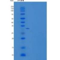 人锌-α-2-糖蛋白/AZGP1/ZAG重组蛋白C-6His
