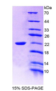 IL19 Recombinant Protein (OPCD04320) using SDS-PAGE