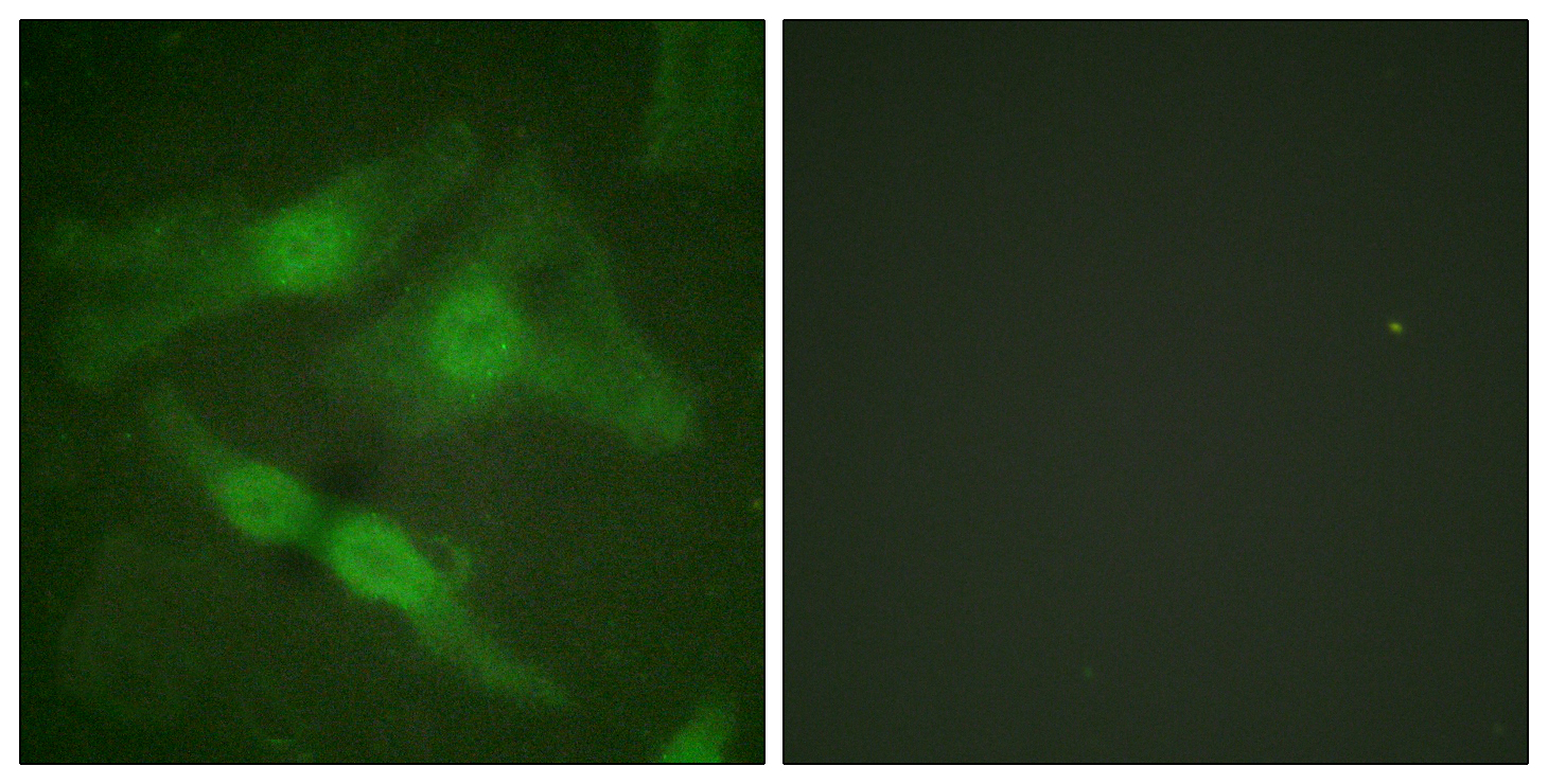 PRKCZ Antibody (Phospho-Thr410) (OAAB20621) in Human HeLa Cells using Immunofluorescence