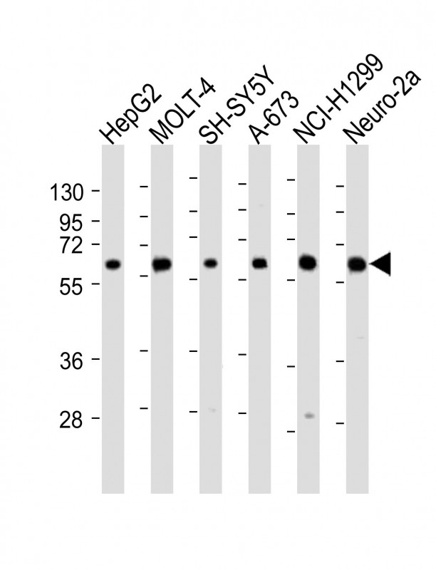 CHRNA4 Antibody - N-terminal region (OAAB21043) in HepG2 cell, MOLT-4 cell, SH-SY5Y cell, A-673 cell, NCI-H1299 cell, Hela cell, using Western Blot