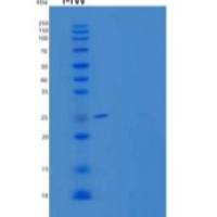 人脂肪细胞粘附分子重组蛋白