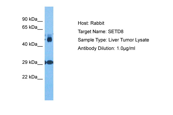 SETD8 Antibody - middle region (ARP77853_P050) in Human Liver Tumor using Western Blot