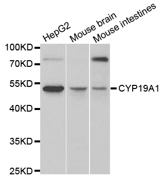 CYP19A1 Antibody (OAAN00762) in Multiple Cell Lines using Western Blot