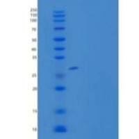 人去唾液酸糖蛋白受体1(ASGR1)重组蛋白