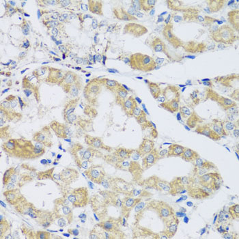 ATPIF1 Antibody (OAAN01164) in Human Stomach using Immunohistochemistry