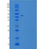 小鼠卷曲同源物2(FZD2)重组蛋白C-Fc