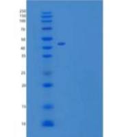 小鼠卷曲同源物2(FZD2)重组蛋白C-Fc