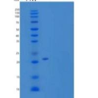 人CLEC4E/Mincel重组蛋白C-6His