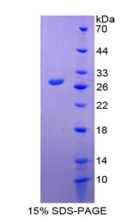 MMP14 Recombinant Protein (OPCD05325) using SDS-PAGE