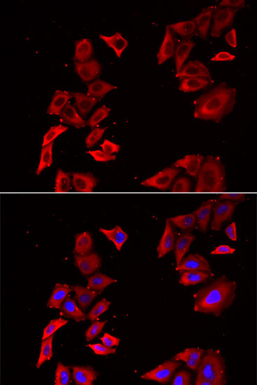 MAP2K5 Antibody (OAAN02068) in U20S Cells using Immunofluorescence