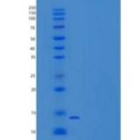 人半乳糖凝集素-7/LGALS7重组蛋白