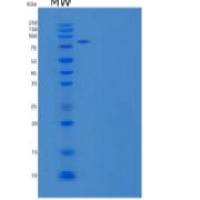 人脑特异性血管生长抑制因子3(BAI3)重组蛋白C-6His