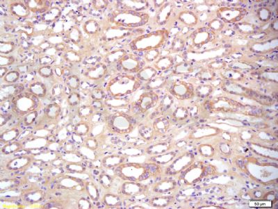 肿瘤转移抑制蛋白BAMBI抗体