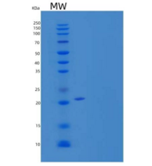 人神经丝束蛋白(NPTN)重组蛋白C-6His