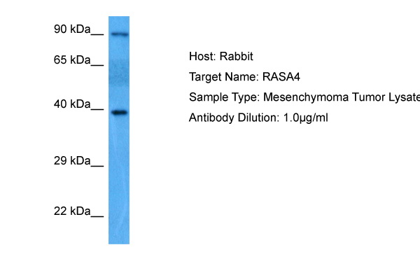 RASA4 Antibody - middle region (ARP76966_P050) in Human Mesenchymoma using Western Blot