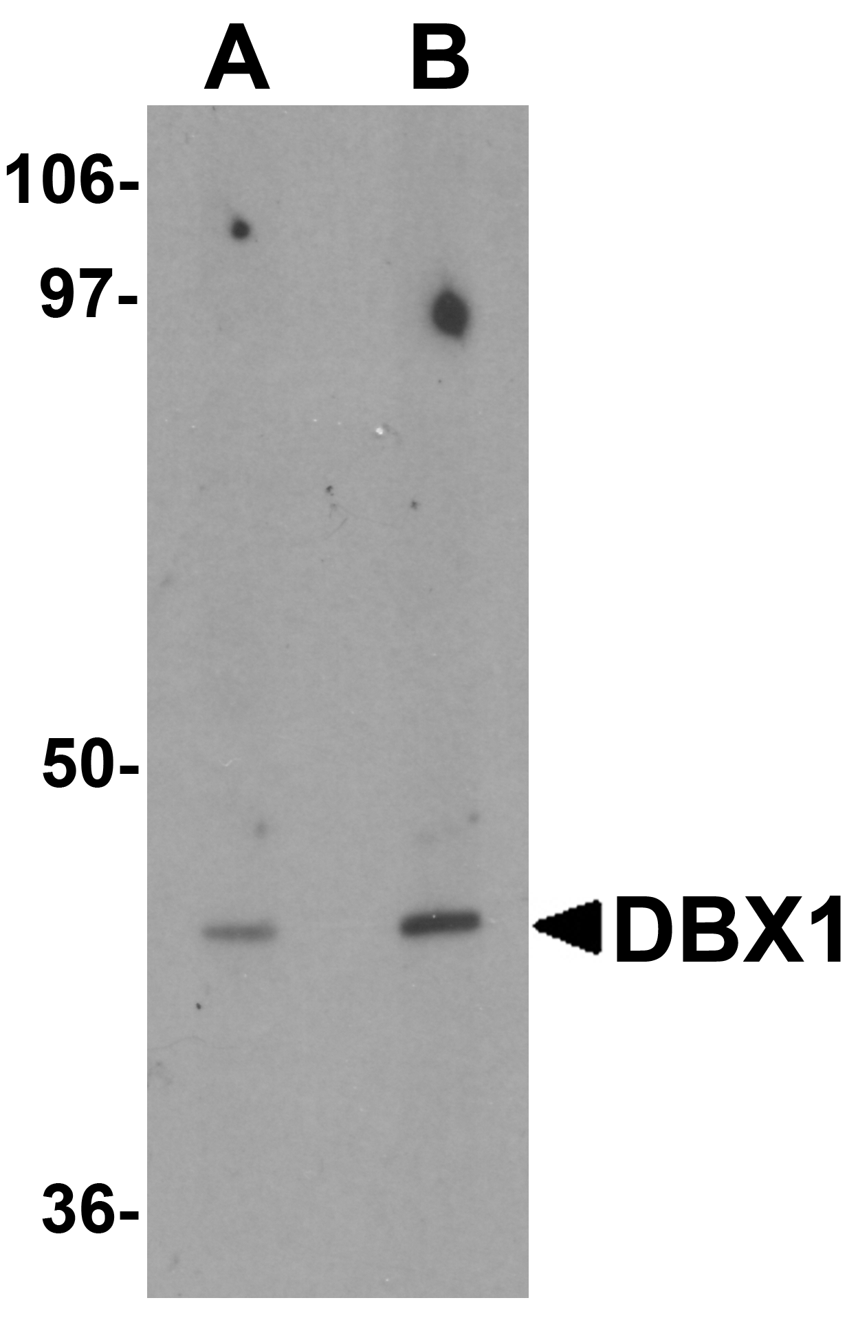 DBX1 Antibody - N-terminal (OAPB01466) in Kidney tissue lysate using Western Blot