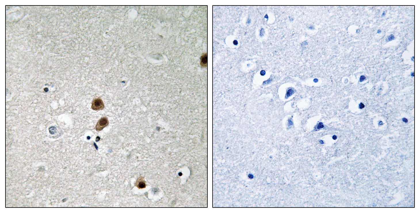 CTBP1 Antibody (Phospho-Ser422) (OAAB20222) in Human Brain Cells using Immunohistochemistry