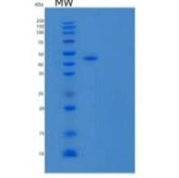 人1A蛋白磷酸酶重组蛋白