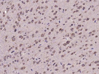 磷酸化真核启动因子2α抗体